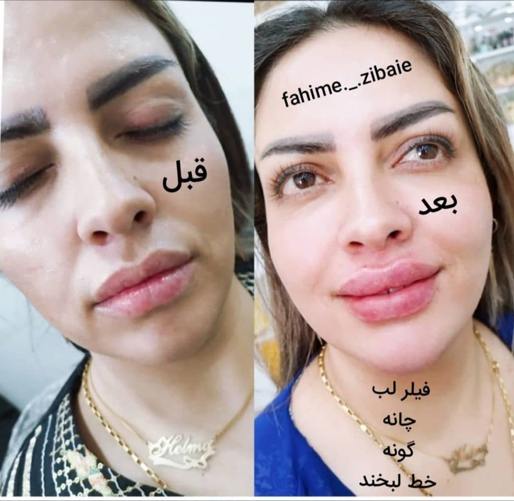 کلینیک زیبایی طنین در فلکه اول صادقیه تهران