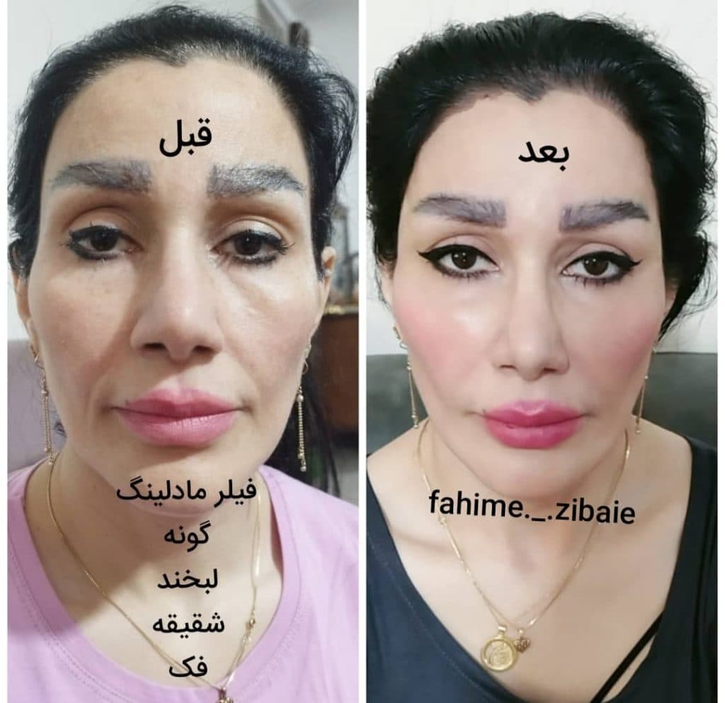 کلینیک زیبایی طنین در فلکه اول صادقیه تهران