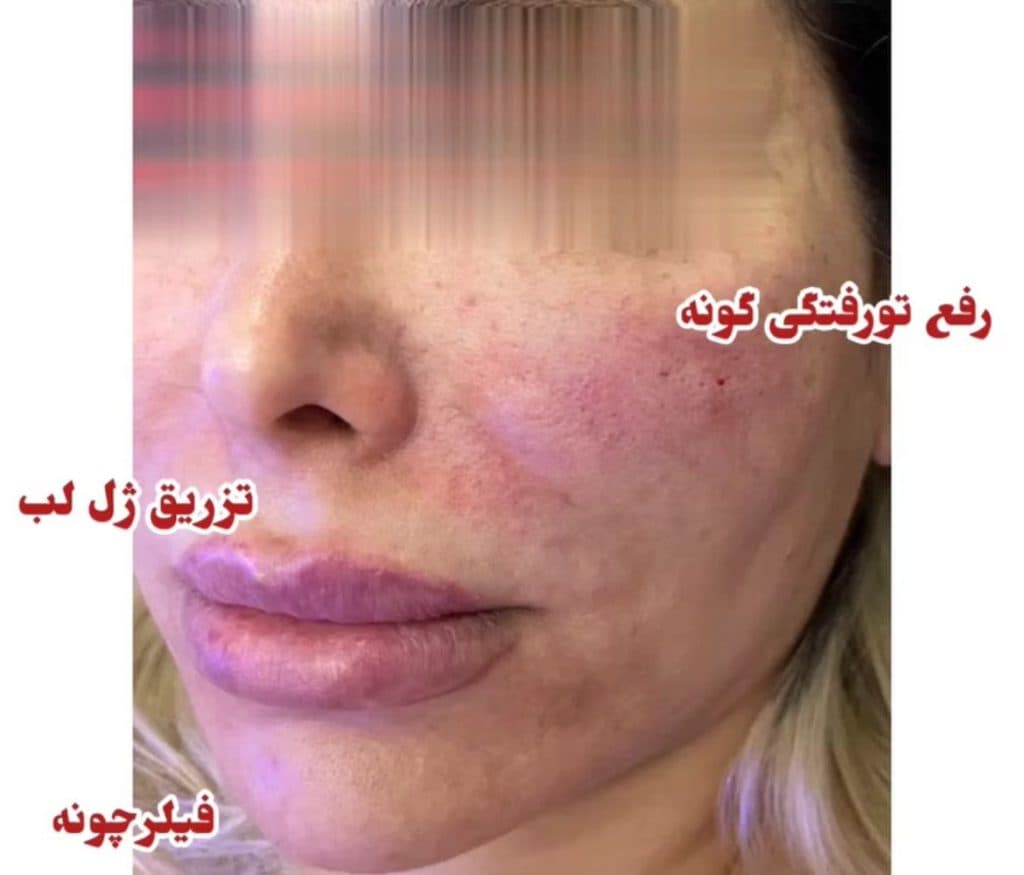 کلینیک زیبایی اوتانا در بلوار فرحزادی تهران