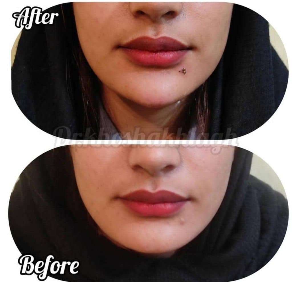 کلینیک زیبایی دکتر مهرناز خوش اخلاق در اهواز