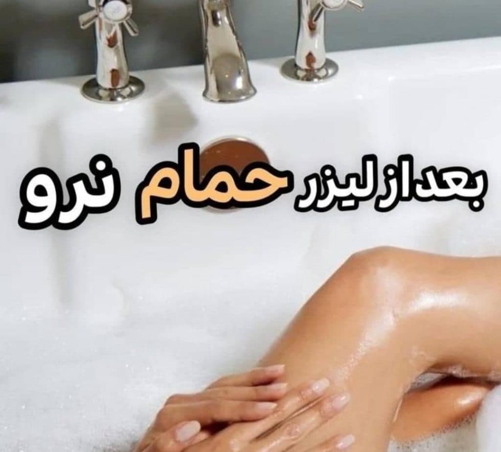 خدمات لیزر موهای زائد سوپرانو تیتانیوم پلاس احلام ناصر در وهابی اهواز