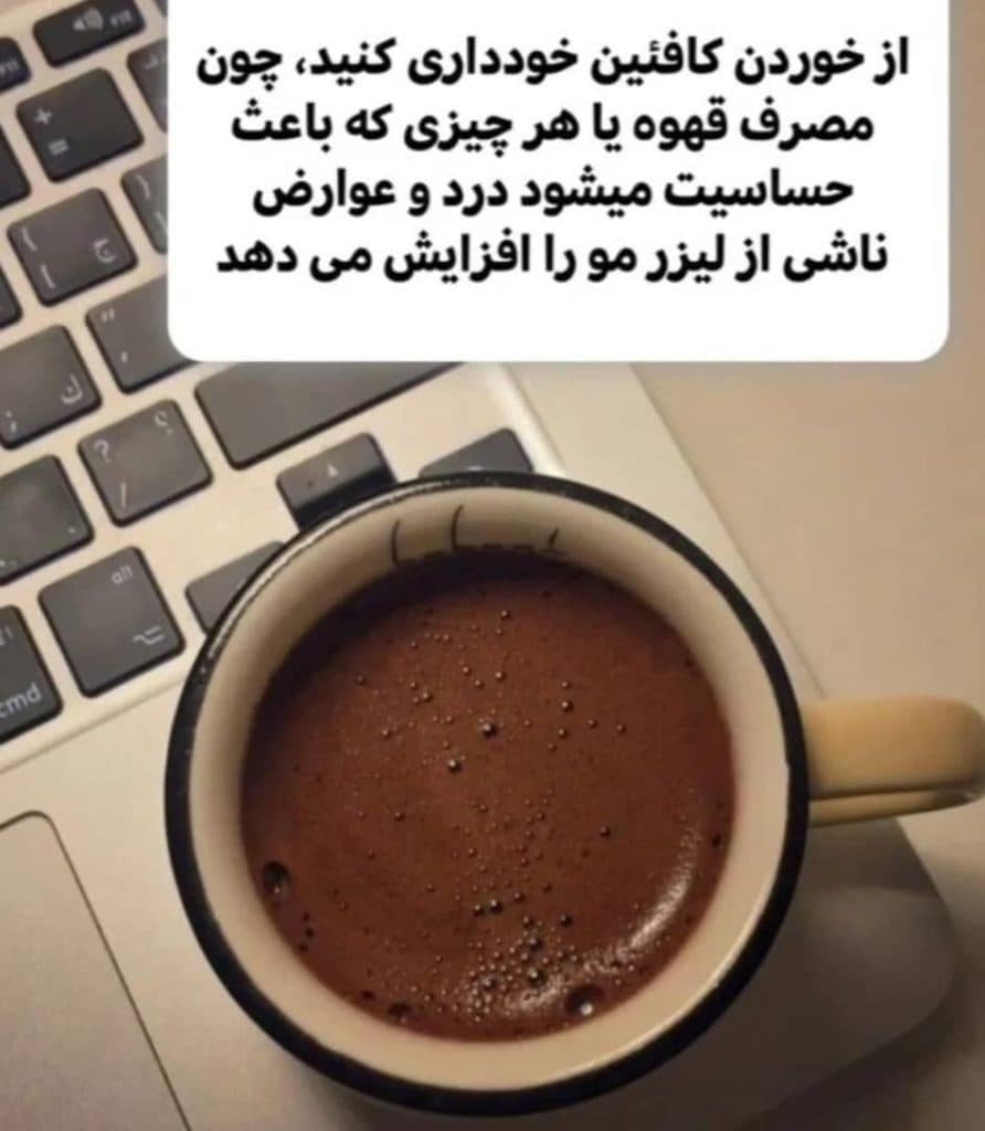 خدمات لیزر موهای زائد سوپرانو تیتانیوم پلاس احلام ناصر در وهابی اهواز