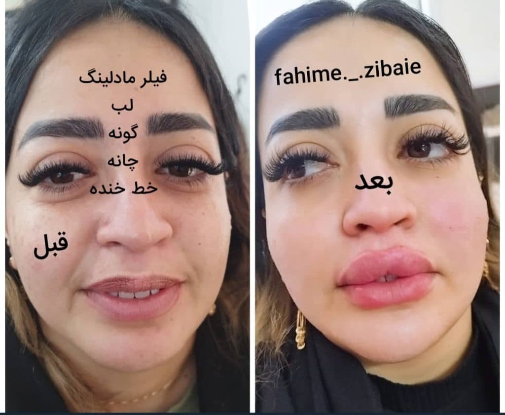 کلینیک زیبایی طنین در فلکه اول صادقیه تهران