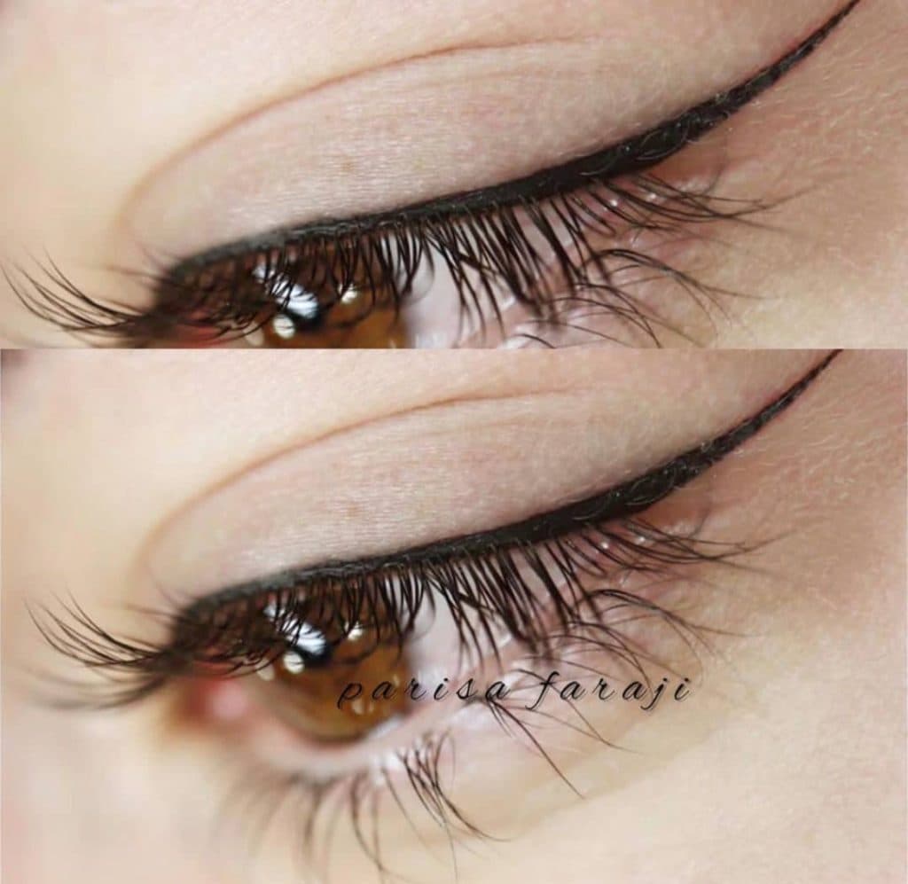 آموزش خدمات تخصصی فیبروز پریسا فرجی در ونک تهران