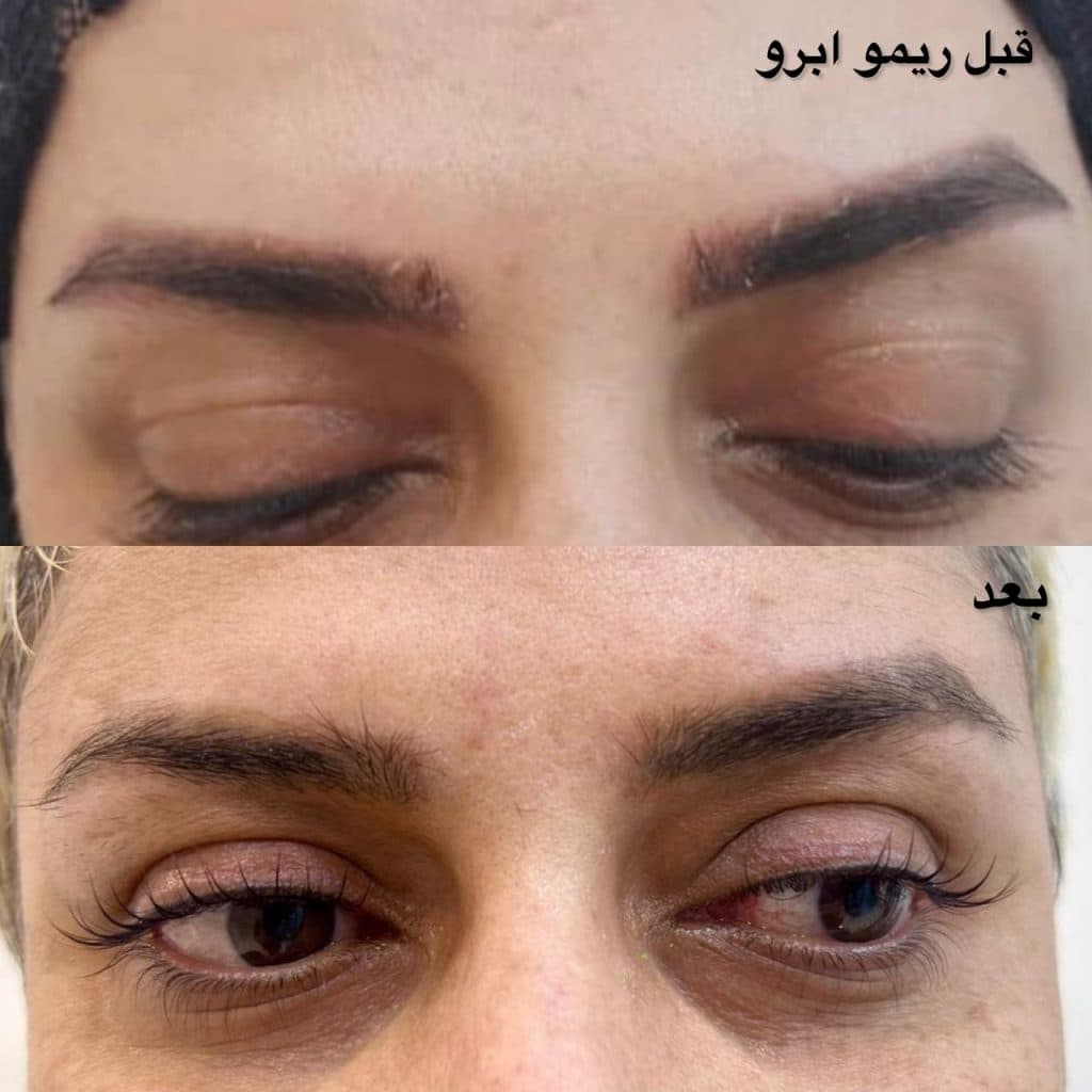 کلینیک زیبایی لیزر دکتر علی کریمی در ایران نژاد سیرجان