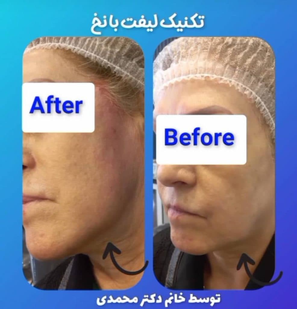 کلینیک زیبایی پوست و مو دکتر زهرا محمدی در چیتگر تهران