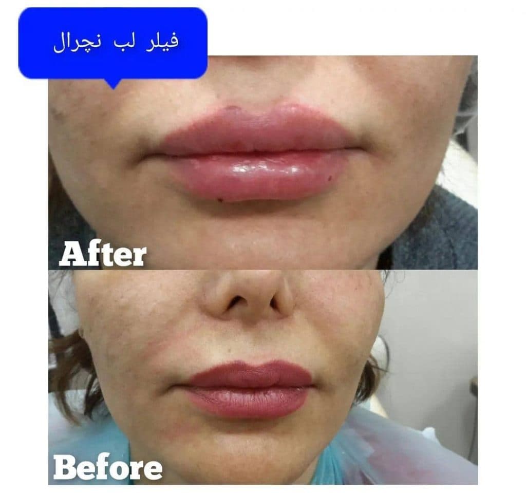 کلینیک زیبایی پوست و مو دکتر زهرا محمدی در چیتگر تهران