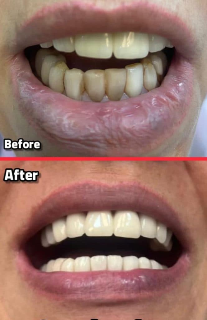 مطب دندانپزشکی دکتر کرسوی در نیاوران تهران