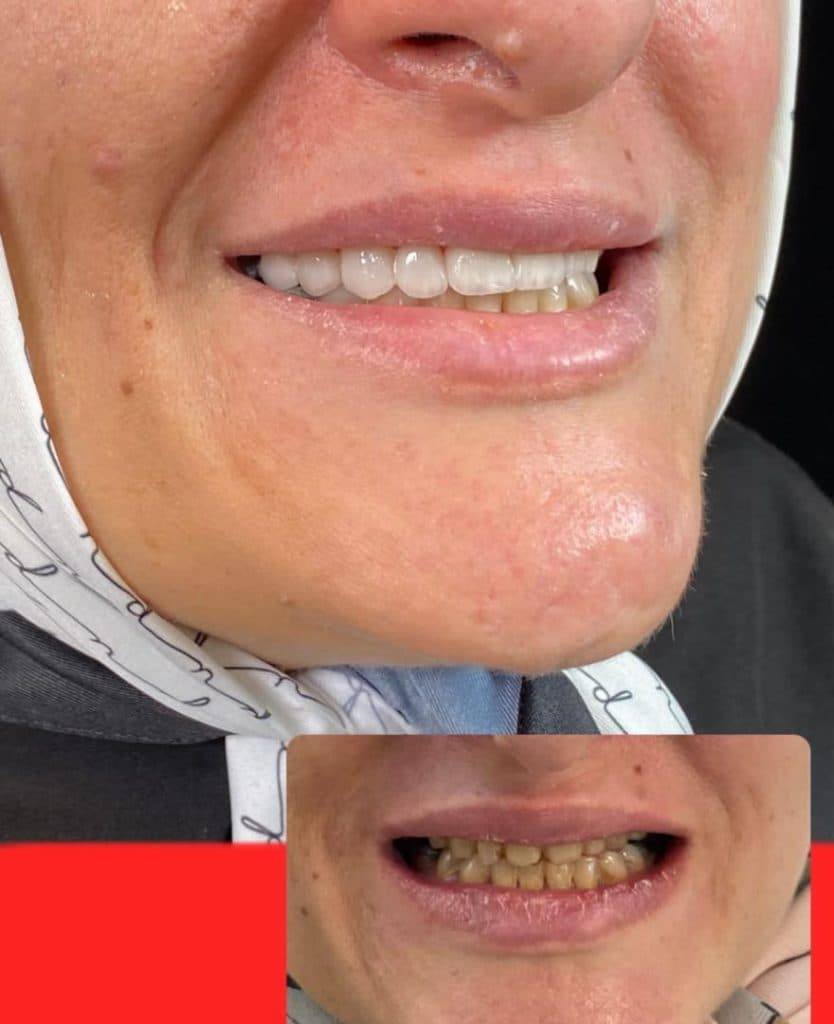 مطب دندانپزشکی دکتر کرسوی در نیاوران تهران