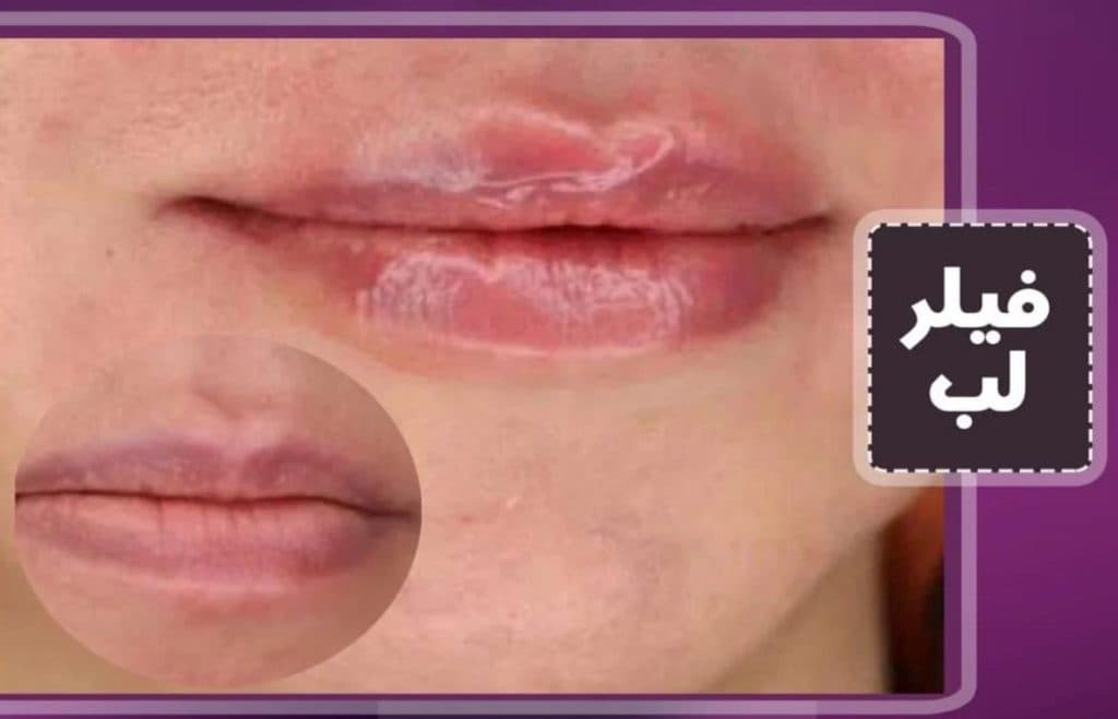 مرکز زیبایی پوست و مو zhilavash در تهرانسر تهران