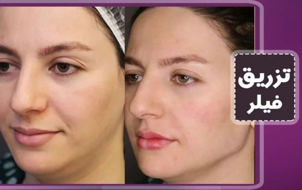 مرکز زیبایی پوست و مو zhilavash در تهرانسر تهران