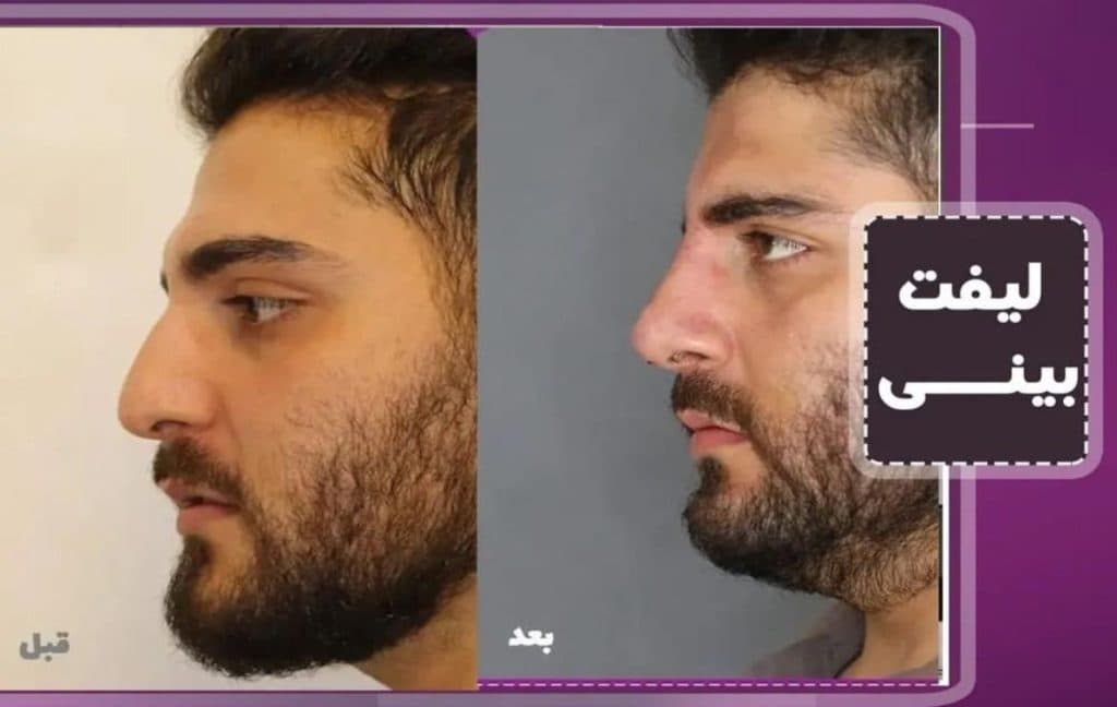 مرکز زیبایی پوست و مو zhilavash در تهرانسر تهران