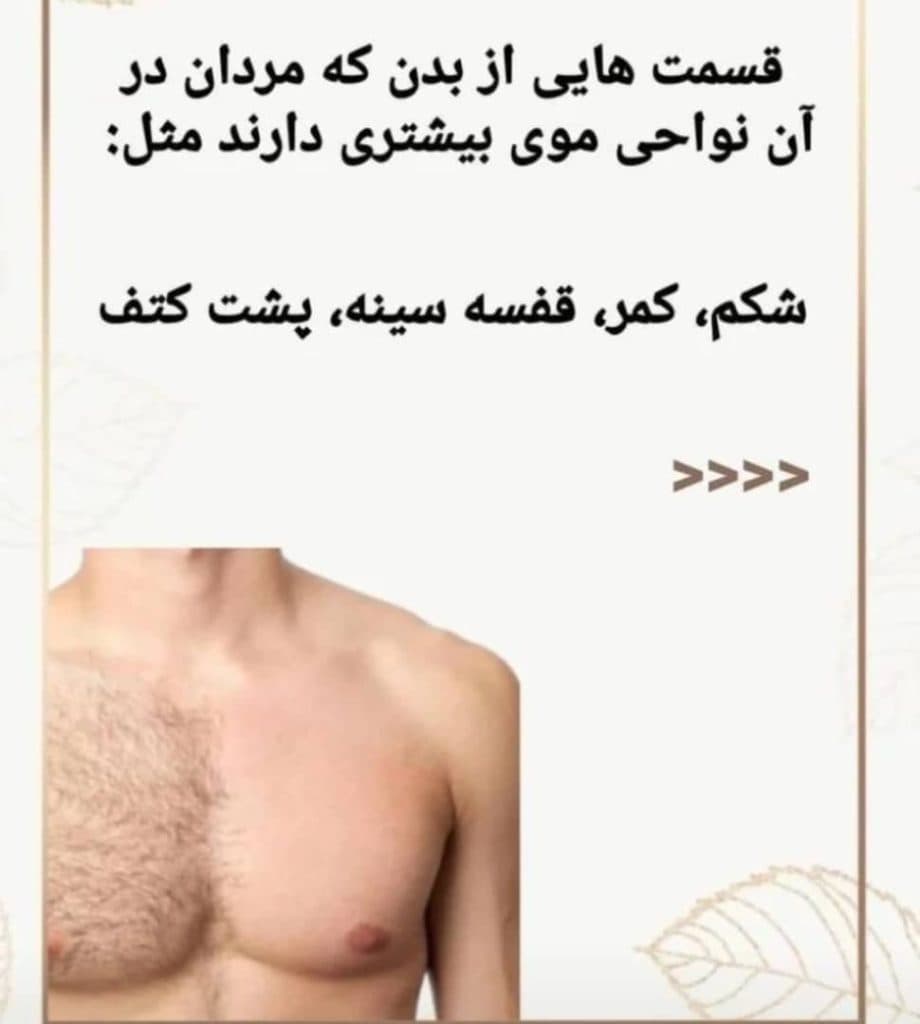 مرکز تخصصی لیزر موهای زائد بانوان و آقایان آیناز در دولت آباد اصفهان