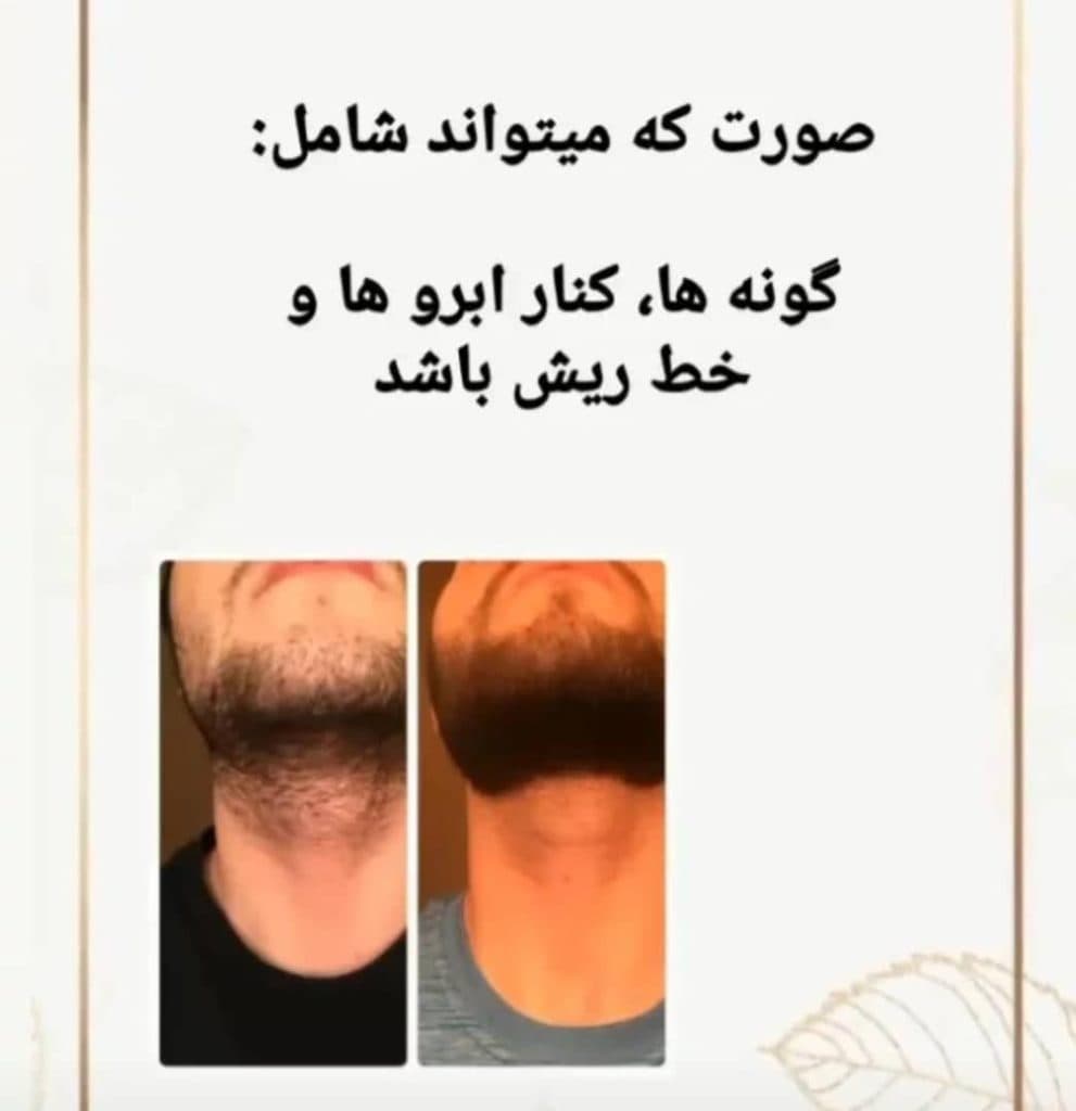 مرکز تخصصی لیزر موهای زائد بانوان و آقایان آیناز در دولت آباد اصفهان