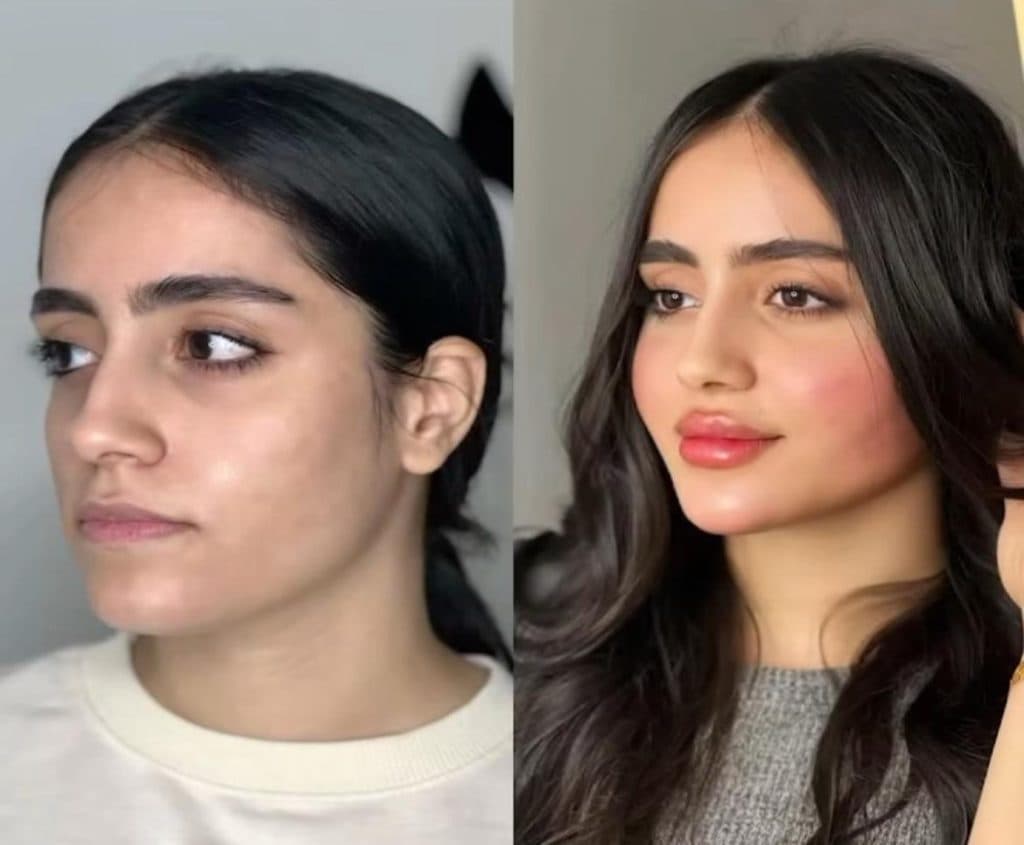 کلینیک زیبایی گل آرا در صادقیه تهران