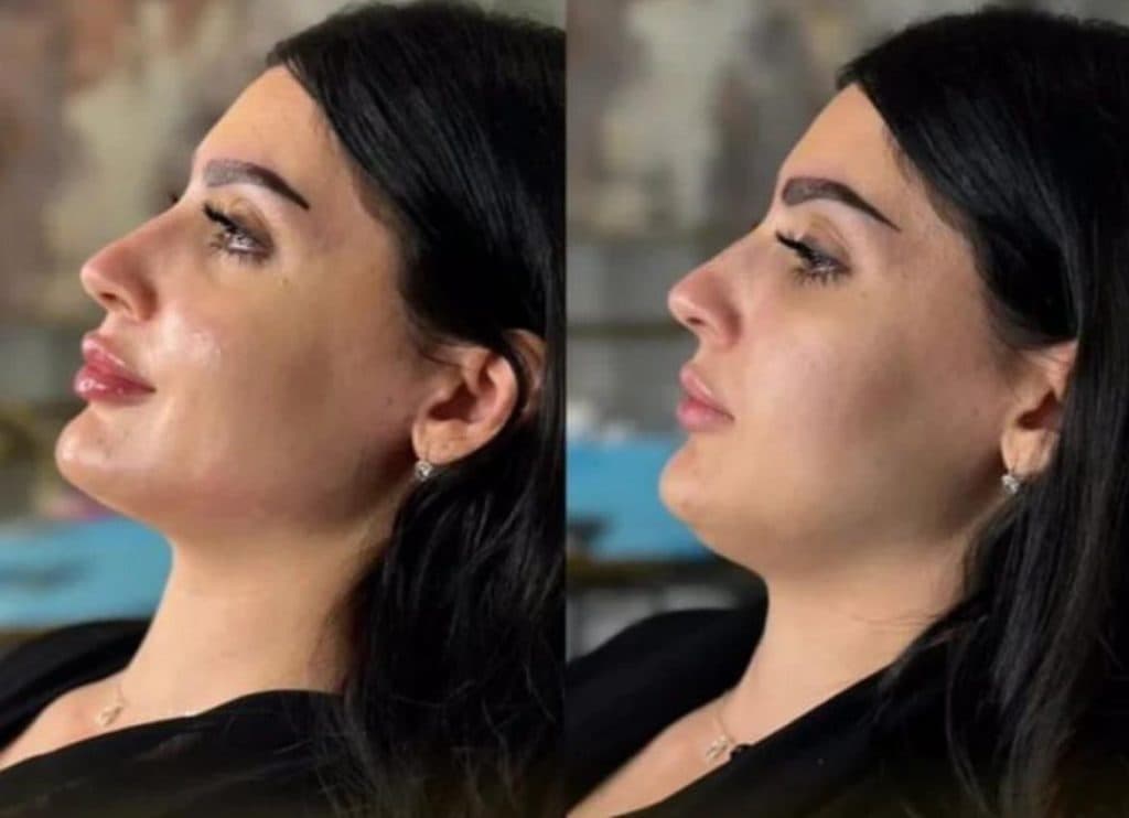 کلینیک زیبایی گل آرا در صادقیه تهران