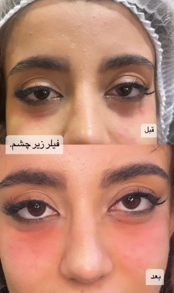 کلینیک زیبایی گل آرا در صادقیه تهران