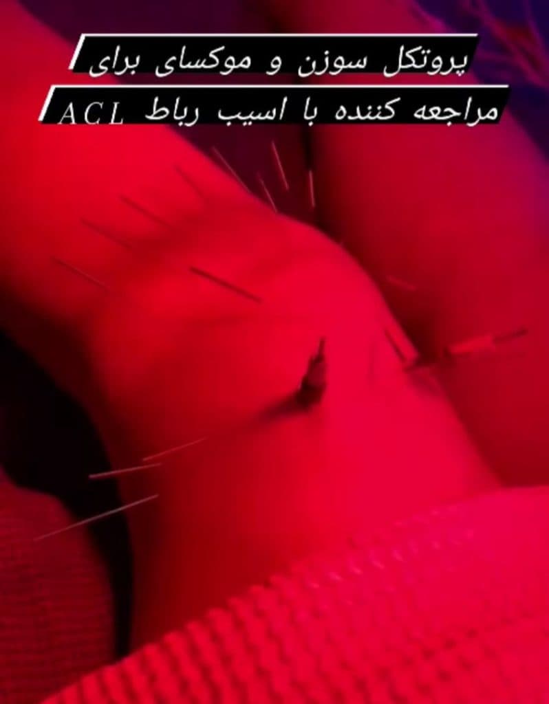 کلینیک تخصصی ماساژ آرامش در ارومیه