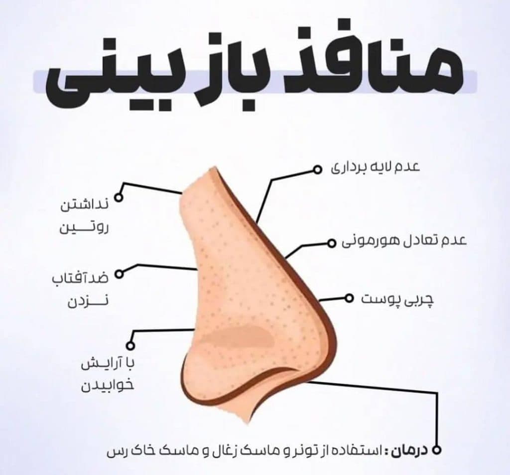 فیشال و پاکسازی پوست فرزانه در شیراز