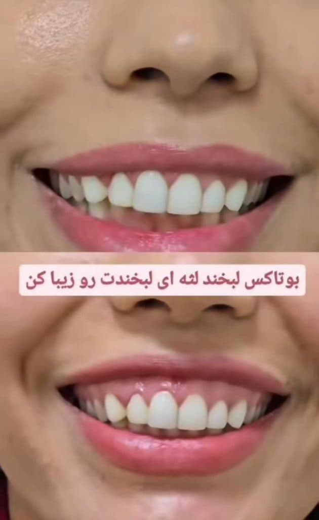 کلینیک زیبایی بهارک جوانی در ستارخان تهران