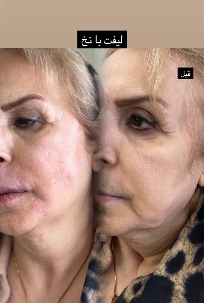 کلینیک زیبایی آرزو در کرج