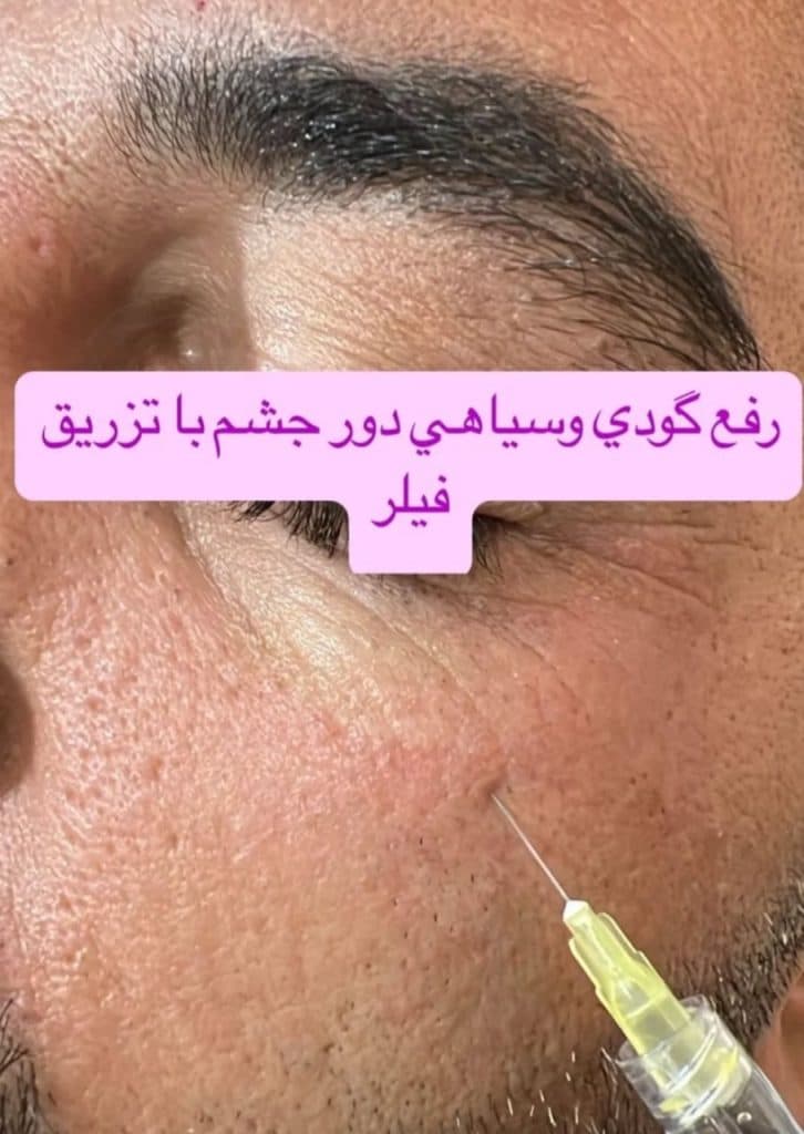 کلینیک زیبایی نسیم نقشبندی در شیخ تپه ارومیه