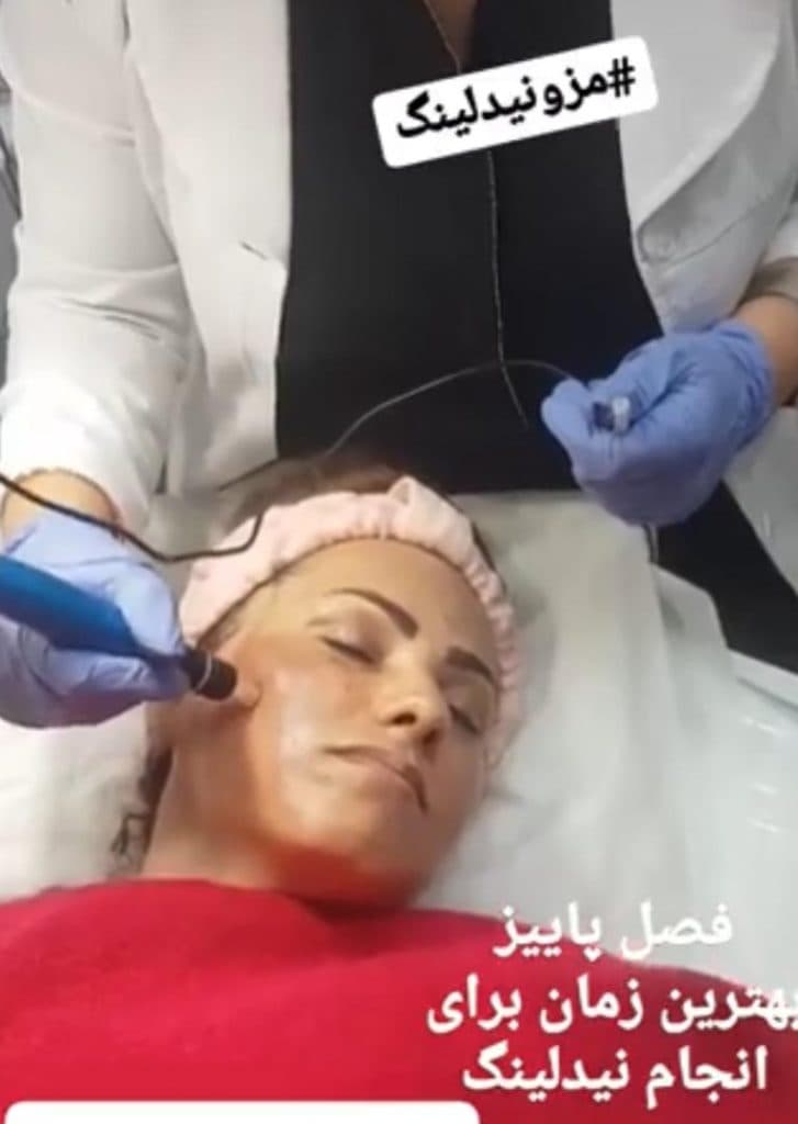 کلینیک طب سوزنی دکتر منوچهر امینی در میدان کشوری بابل