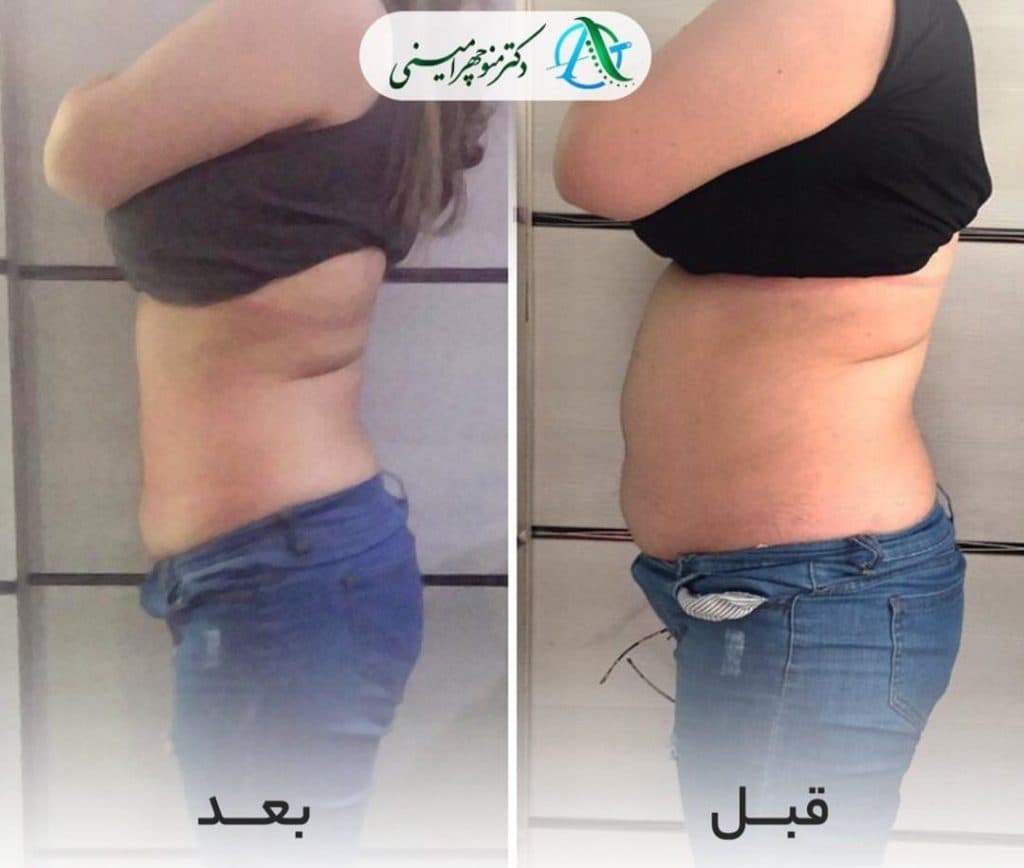 کلینیک طب سوزنی دکتر منوچهر امینی در میدان کشوری بابل