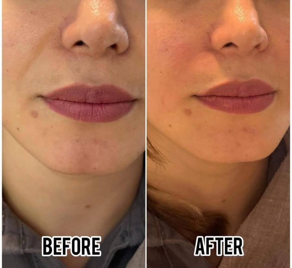 کلینیک تخصصی تزریق ژل و بوتاکس دکتر حج فروشان در خیام 46 مشهد