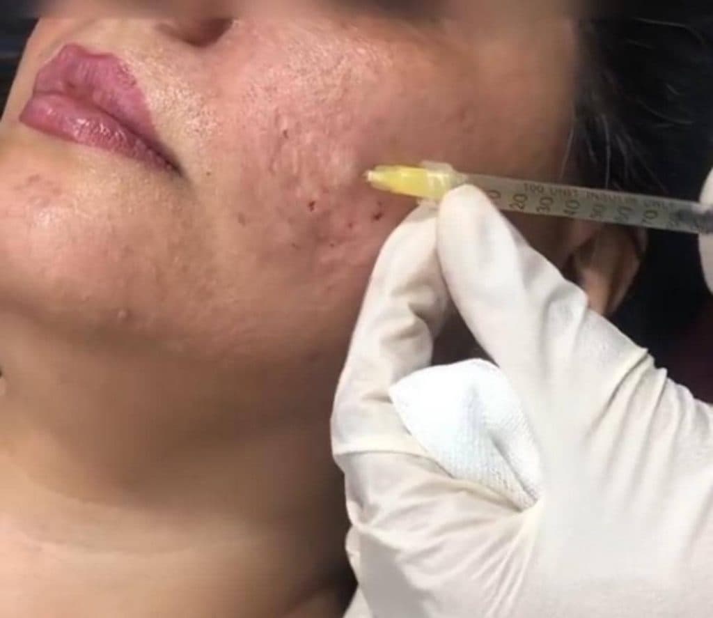 کلینیک تخصصی تزریق ژل و بوتاکس دکتر حج فروشان در خیام 46 مشهد