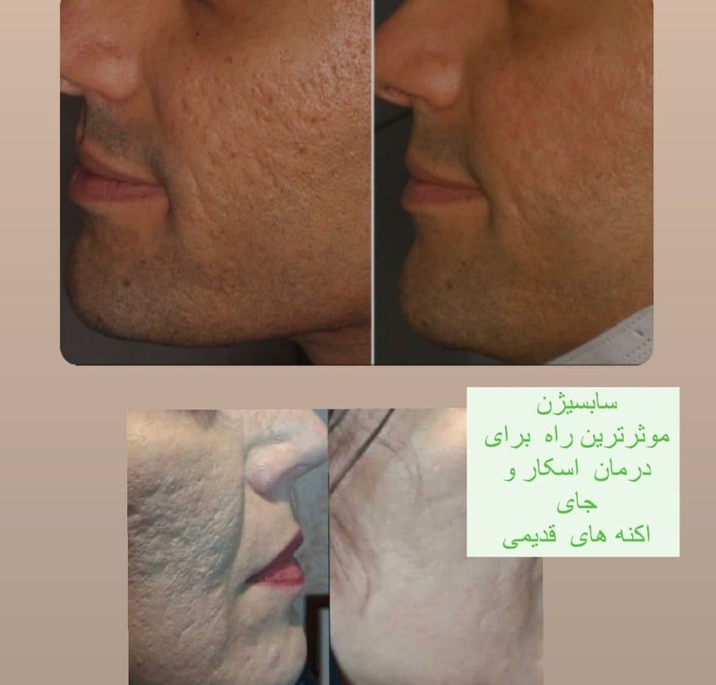 مطب زیبایی شات لیزر در توحید میانی اصفهان