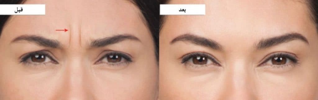 مطب زیبایی شات لیزر در توحید میانی اصفهان