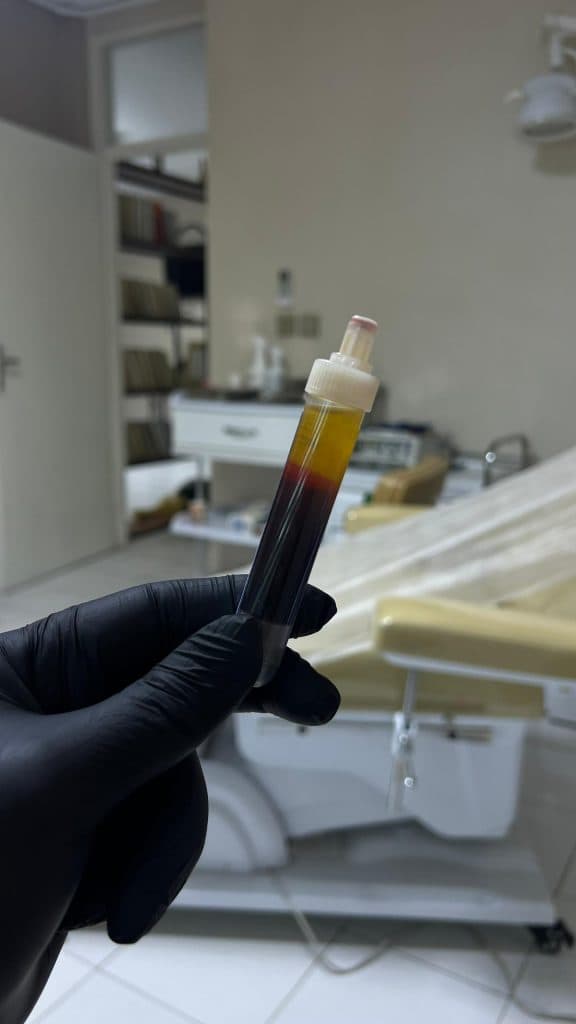 مرکز تخصصی پروتوکین تراپی رها در سنگ فرش ولیعصر تبریز