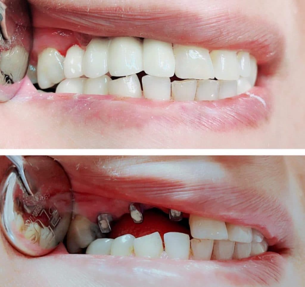 مطب دندانپزشکی دکتر سحر حسین خانی در شهرک اکباتان تهران