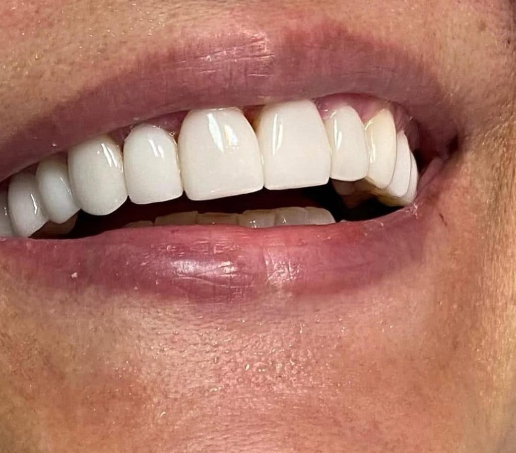 مطب دندانپزشکی دکتر سحر حسین خانی در شهرک اکباتان تهران