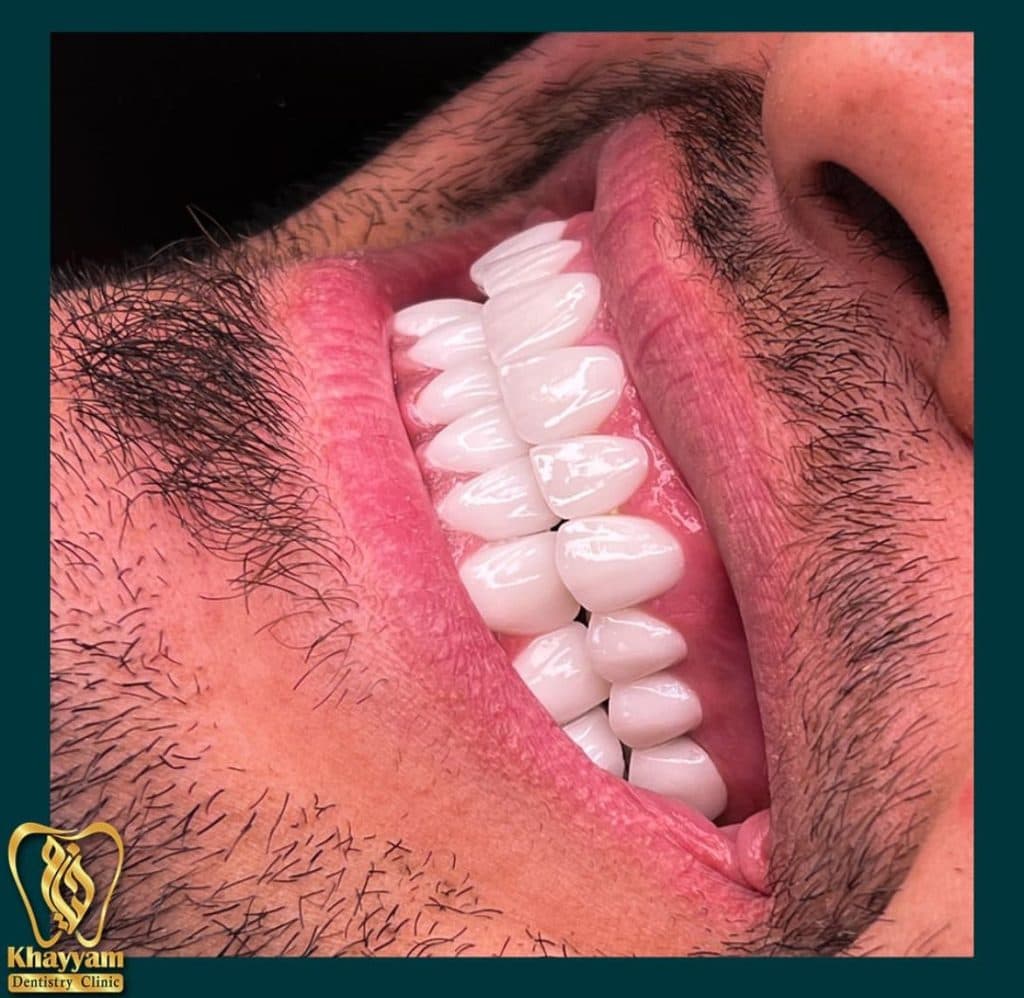 کلینیک تخصصی دندانپزشکی خیام در ائل گلی تبریز