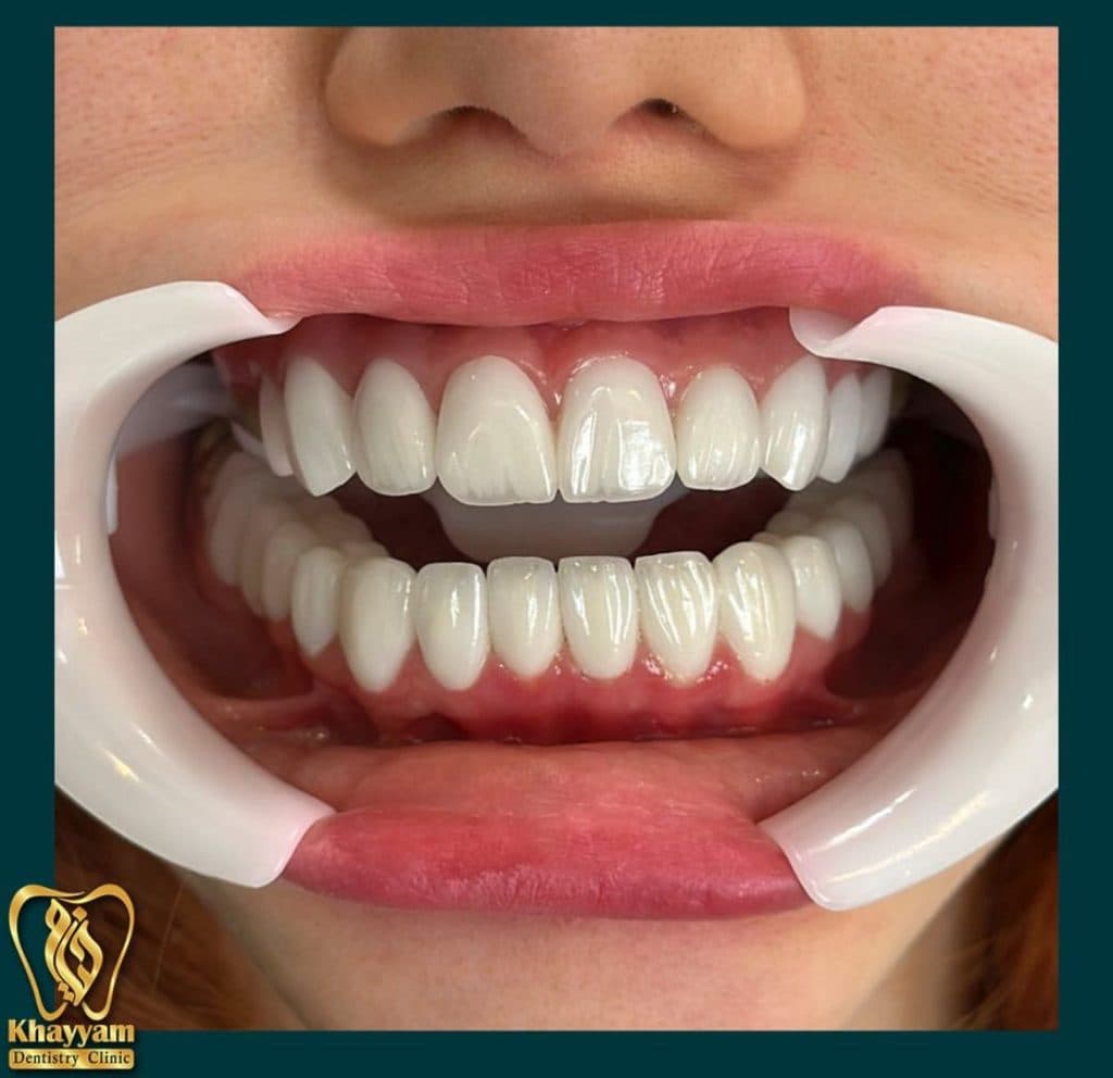 کلینیک تخصصی دندانپزشکی خیام در ائل گلی تبریز