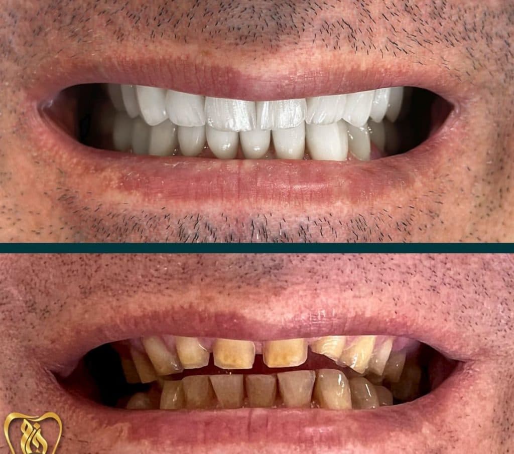 کلینیک تخصصی دندانپزشکی خیام در ائل گلی تبریز