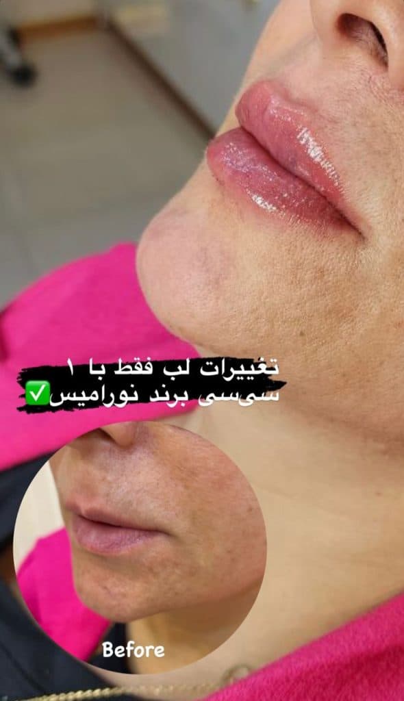 هایفوتراپی دکتر لیلا صلاحی در همدان