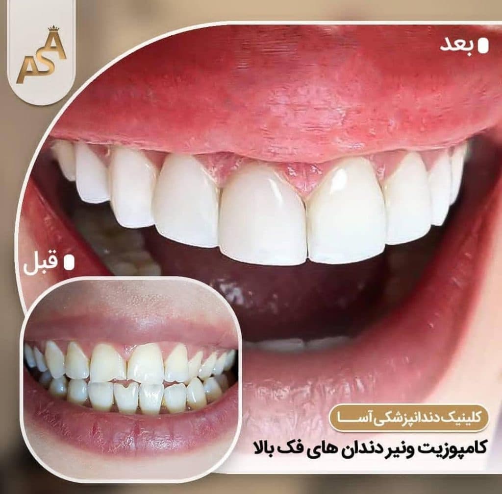 کلینیک دندانپزشکی آسا در کرمانشاه