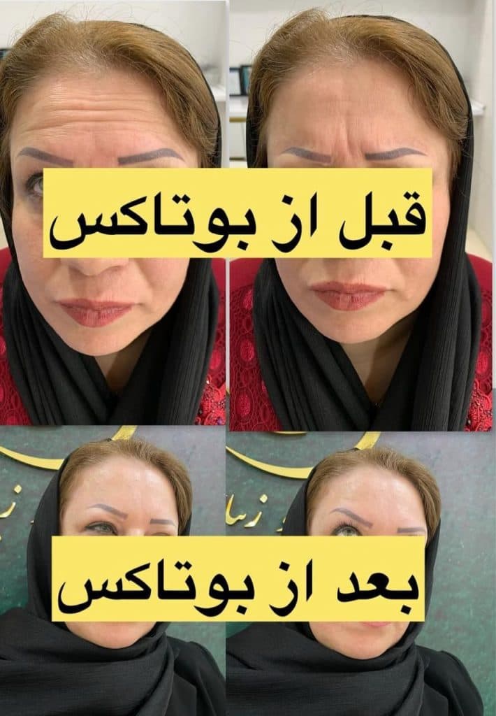 کلینیک زیبایی رافا در عبدل آباد تهران