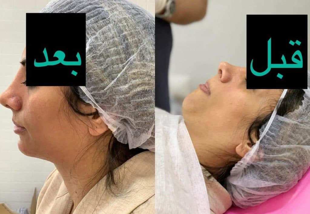 کلینیک زیبایی رافا در عبدل آباد تهران