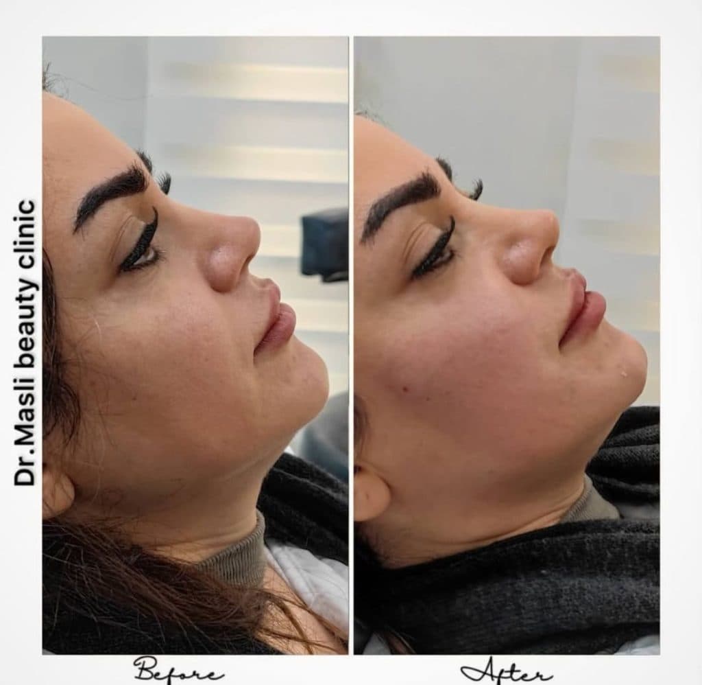 کلینیک زیبایی و لیزر مسلی در چیتگر تهران