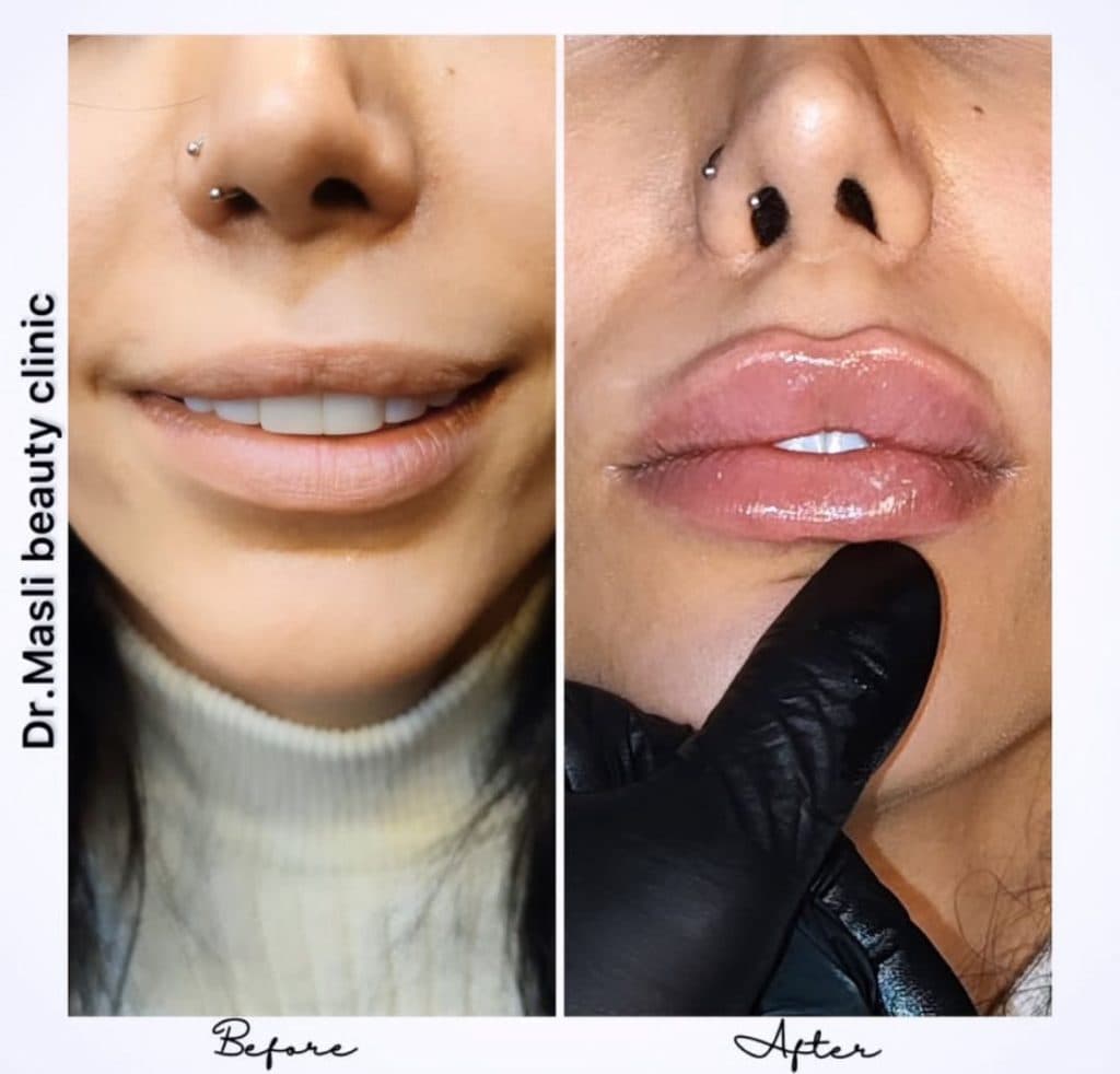 کلینیک زیبایی و لیزر مسلی در چیتگر تهران