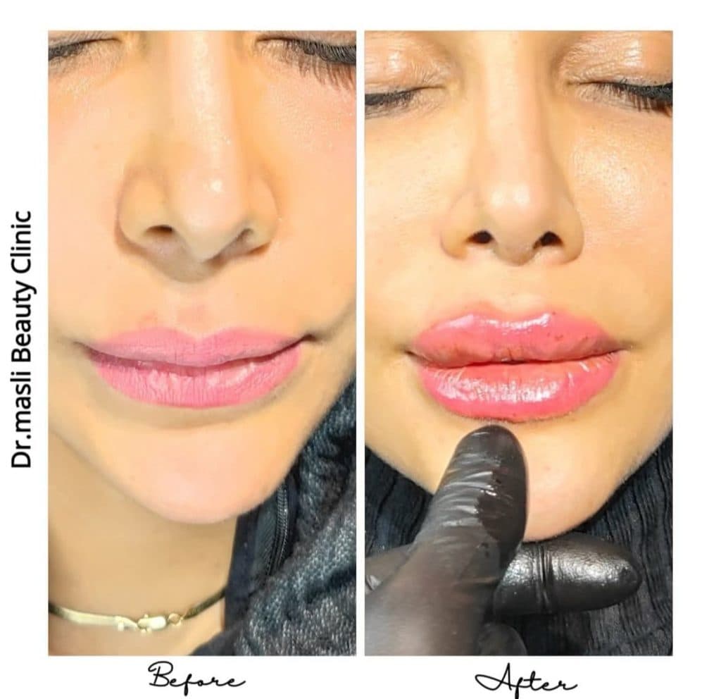 کلینیک زیبایی و لیزر مسلی در چیتگر تهران