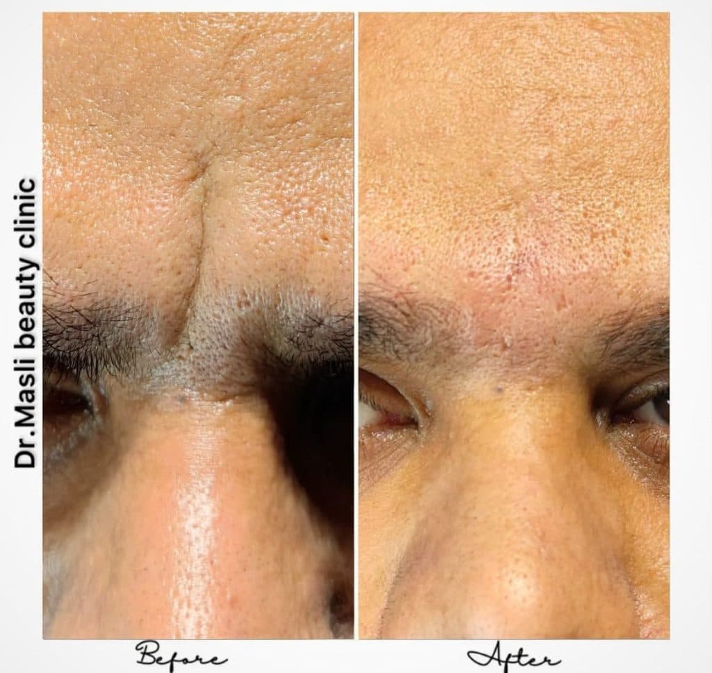 کلینیک زیبایی و لیزر مسلی در چیتگر تهران