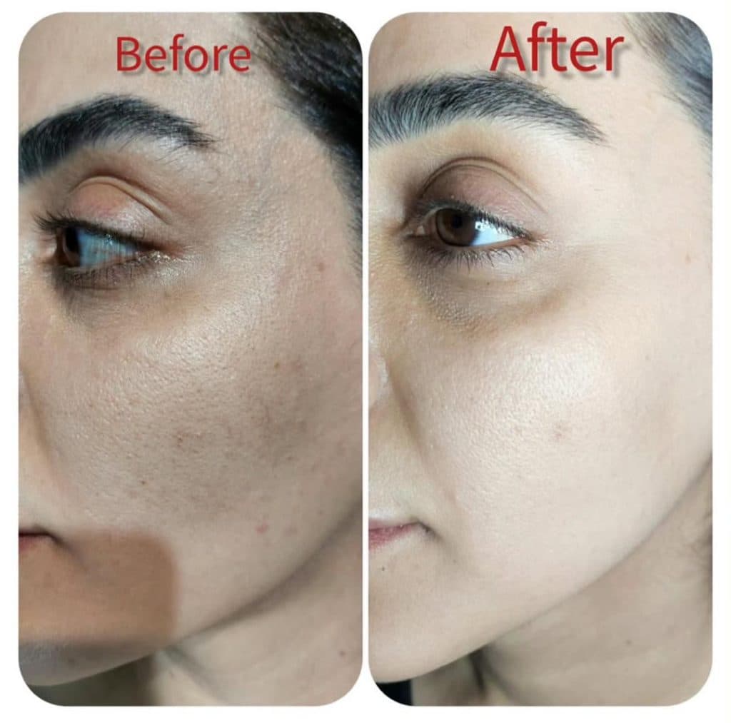 کلینیک زیبایی و لیزر مسلی در چیتگر تهران