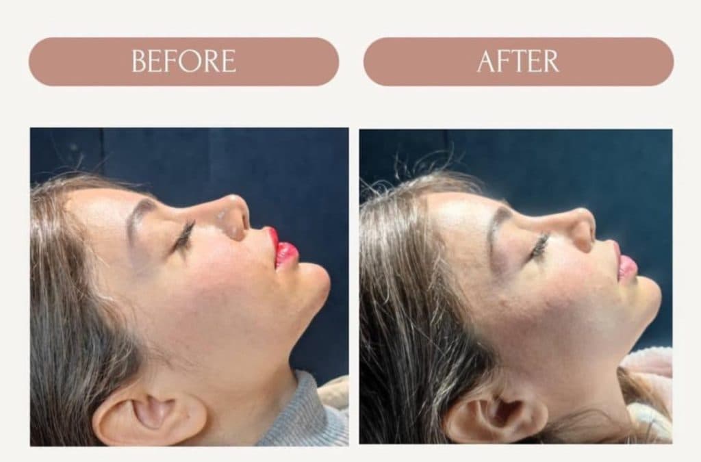 کلینیک زیبایی و لیزر مسلی در چیتگر تهران