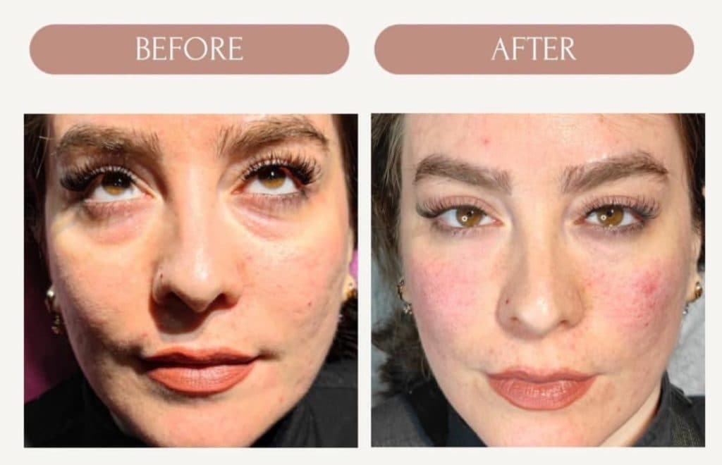 کلینیک زیبایی و لیزر مسلی در چیتگر تهران