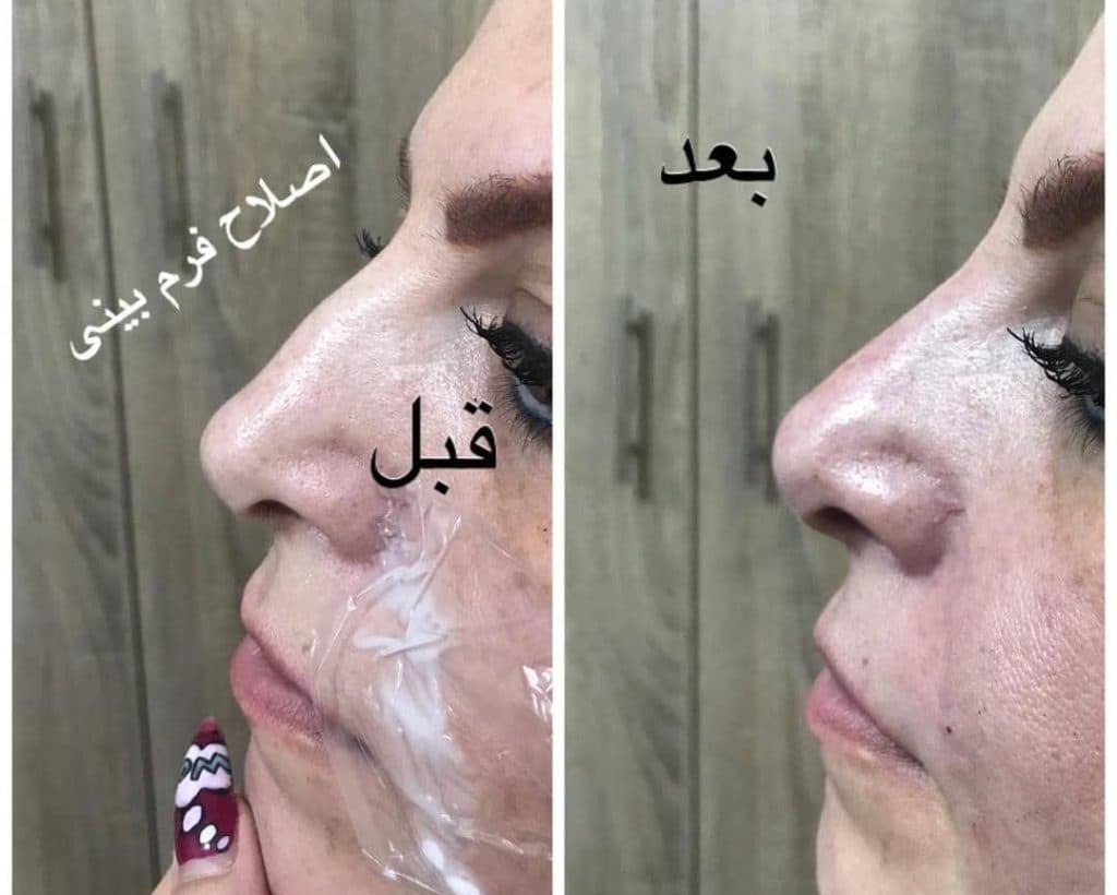 کلینیک زیبایی آرزو در کرج